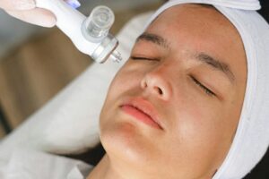Acne Care Treatments Coventry CT