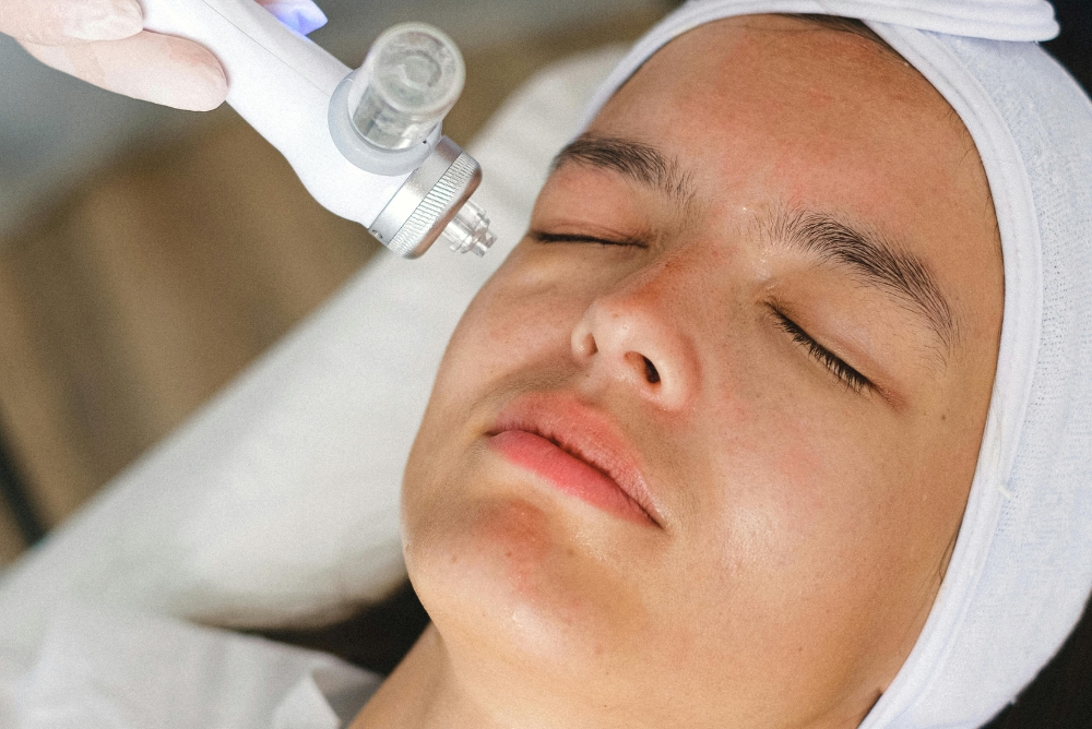 Acne Care Treatments Coventry CT